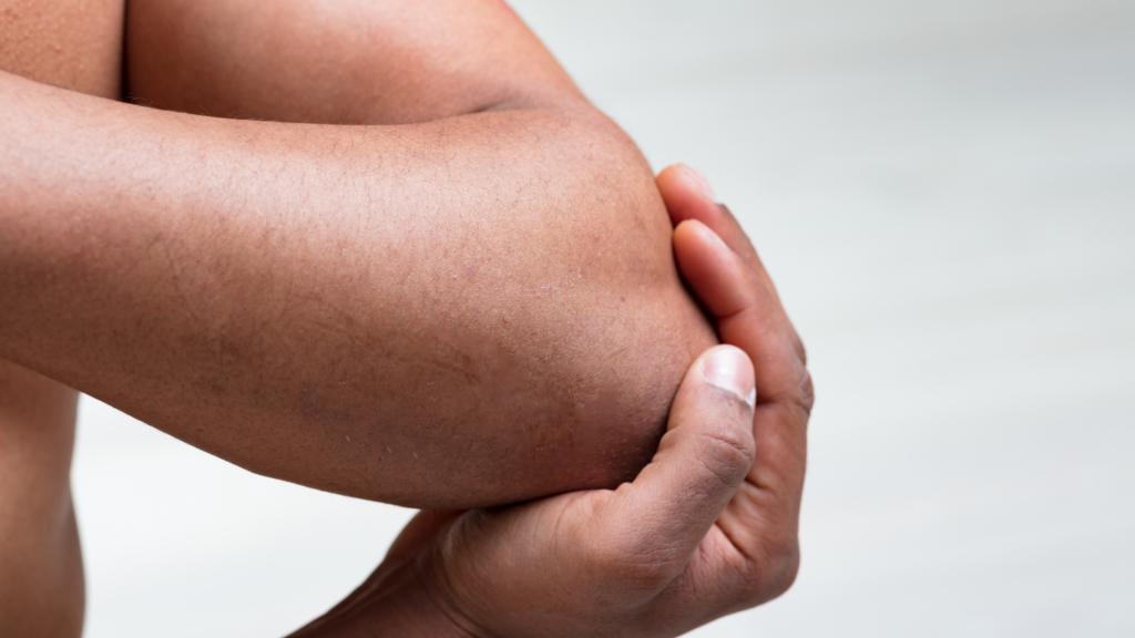 a close up of a person holding their elbow